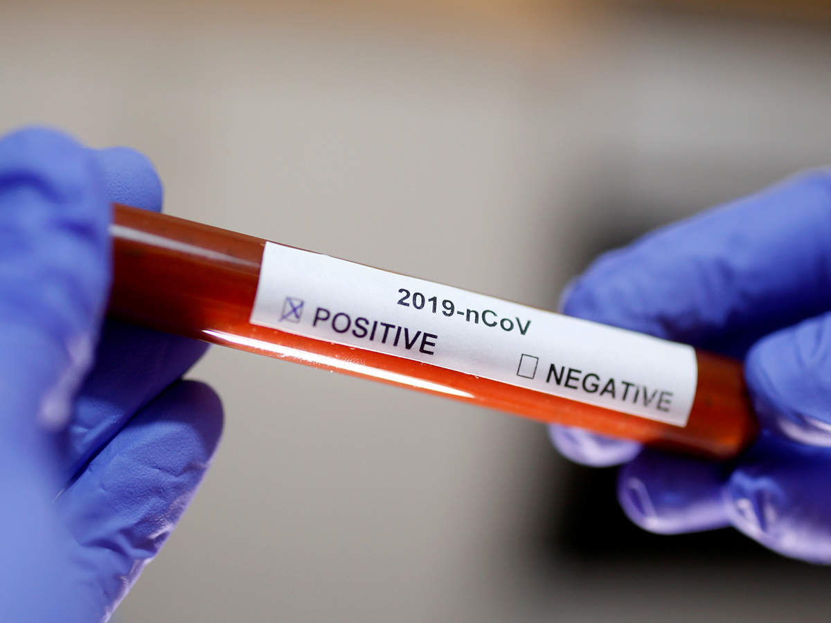 coronavirus blood sample