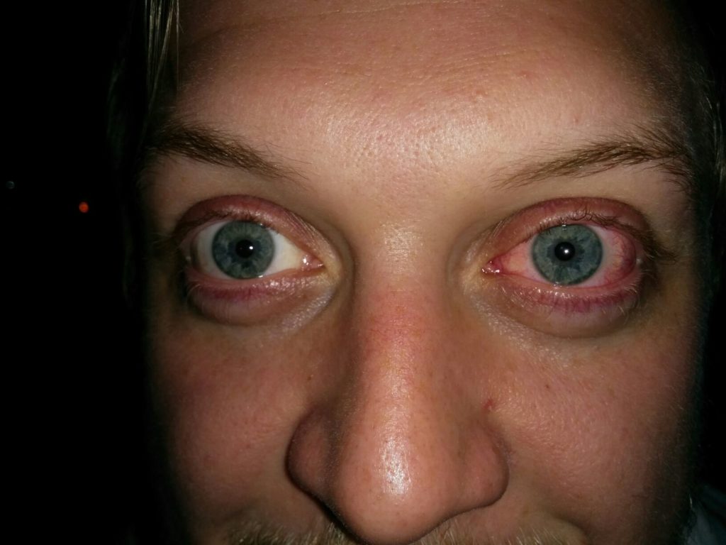 High Person Red How Can You Tell if Someone Is High on Drugs?